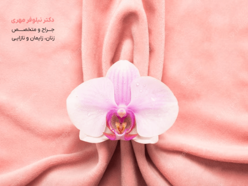 لابیاپلاستی