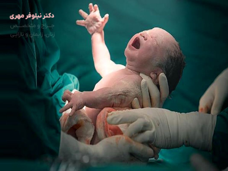 زایمان طبیعی-شاخص
