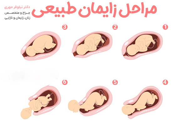 مراحل زایمان طبیعی