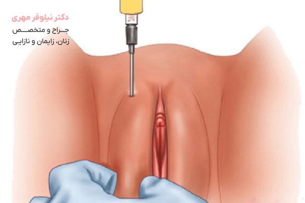 آمادهسازی روحی و ذهنی