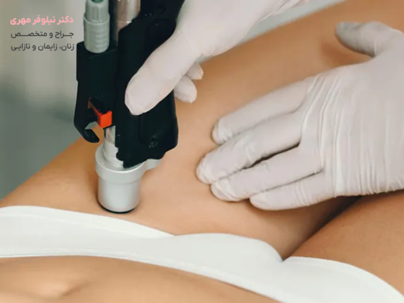 روشن کردن ناحیه تناسلی