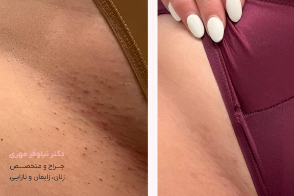 علت تیرگی ناحیه تناسلی چیست؟